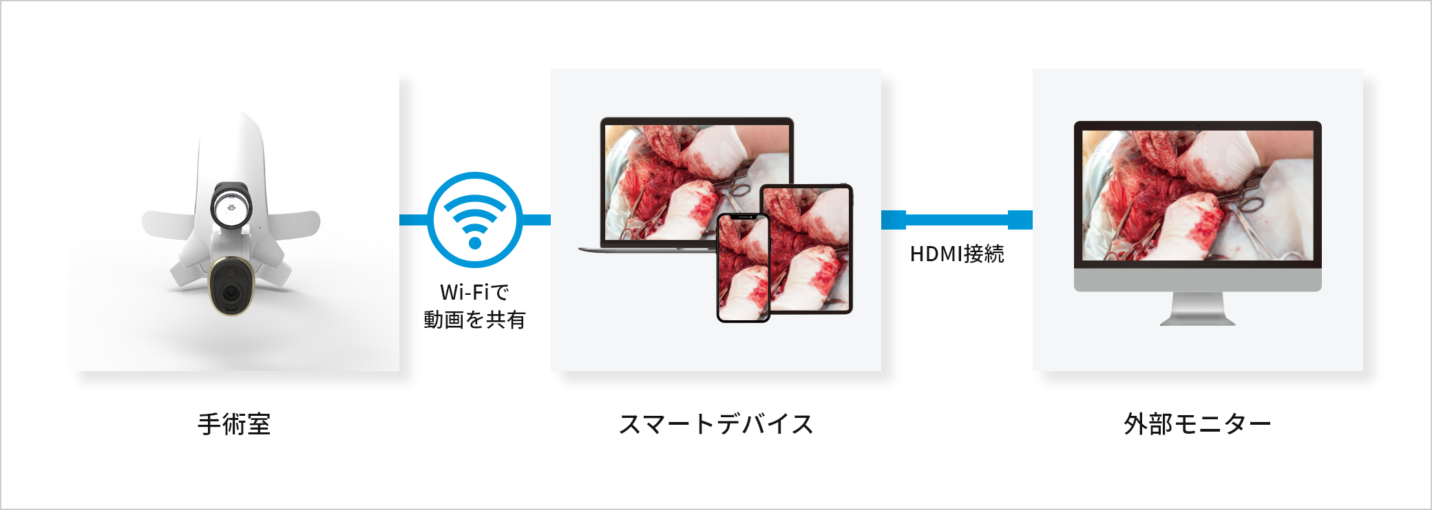 FM-105HS/FASMEDO使用イメージ