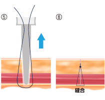 グラスパ―ガイドの使い方5-6